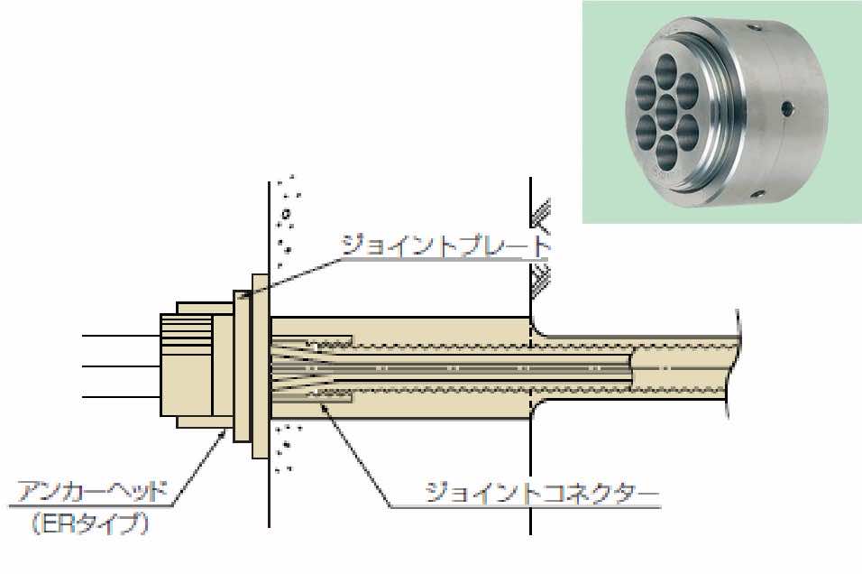 調整型定着具(ERタイプ)