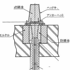 J1永久アンカー